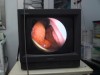 2例目のラブラドールの胃内の内視鏡像。米粒、スイカとその種・・・、この症例も団子と串を探すのは容易ではなかった。モニター左下の6-8時の位置にあるのが串。その上方が団子で、右12